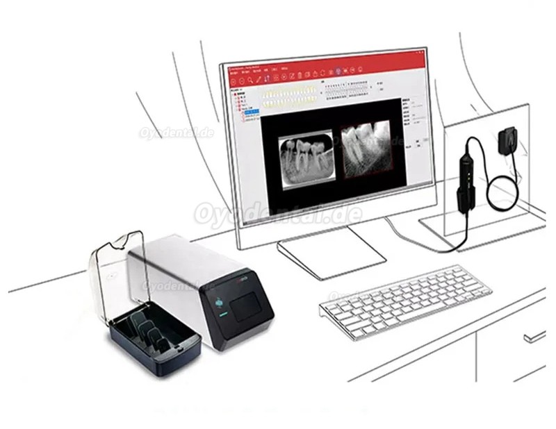 Handy HDS-500 Intraoral-Speicherfolienscanner PSP-Scanner